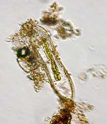 Cymatopleura sp. Bildbreite: 160 µm; 29.12.2003