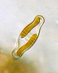 Navicula?; Bild 30 µm breit, 31.12.2003