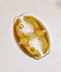 Amphora ovalis; Bild 50 µm breit, 31.12.2003