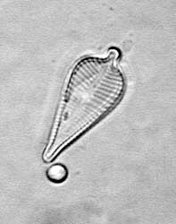 Kieselalge. Bildbreite: 45 µm; 2.1.2004