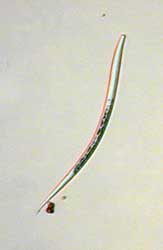Nematode; Bildbreite: 200 µm breit, 31.12.2003