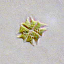 Pediastrum tetras. Bildbreite: 35 µm; 2.1.2004