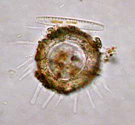 Schalenamöbe. 90 µm breit, 29.12.2003