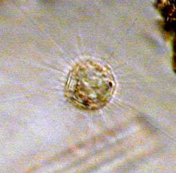 Sonnentierchen; Bildbreite: 55 µm breit, 31.12.2003